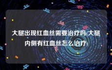 大腿出现红血丝需要治疗吗(大腿内侧有红血丝怎么治疗)